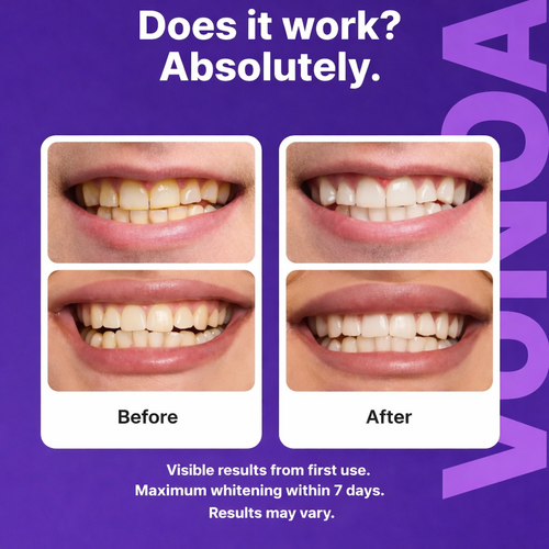 Avunoa Purple Whitening Strips™